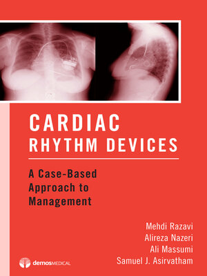 cover image of Cardiac Rhythm Devices
